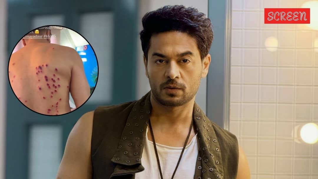 Gaurav Khanna bị thương nghiêm trọng khi thực hiện thử thách tại Khatron Ke Khiladi 15 (Ảnh: The Indian Express)